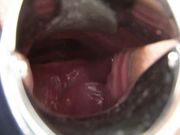 HD 4K 水着姉妹 特別トリート メント