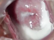 大鸡巴口罩哥和人见人爱的萝莉美眉PP自拍干完内窥一下逼逼内部